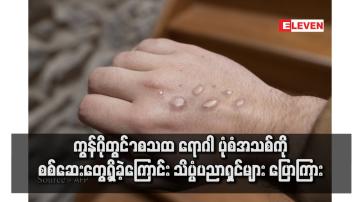 Embedded thumbnail for ကွန်ဂိုတွင် mpox ရောဂါ ပုံစံအသစ်ကို စစ်ဆေးတွေ့ရှိခဲ့ကြောင်း သိပ္ပံပညာရှင်များ ပြောကြား